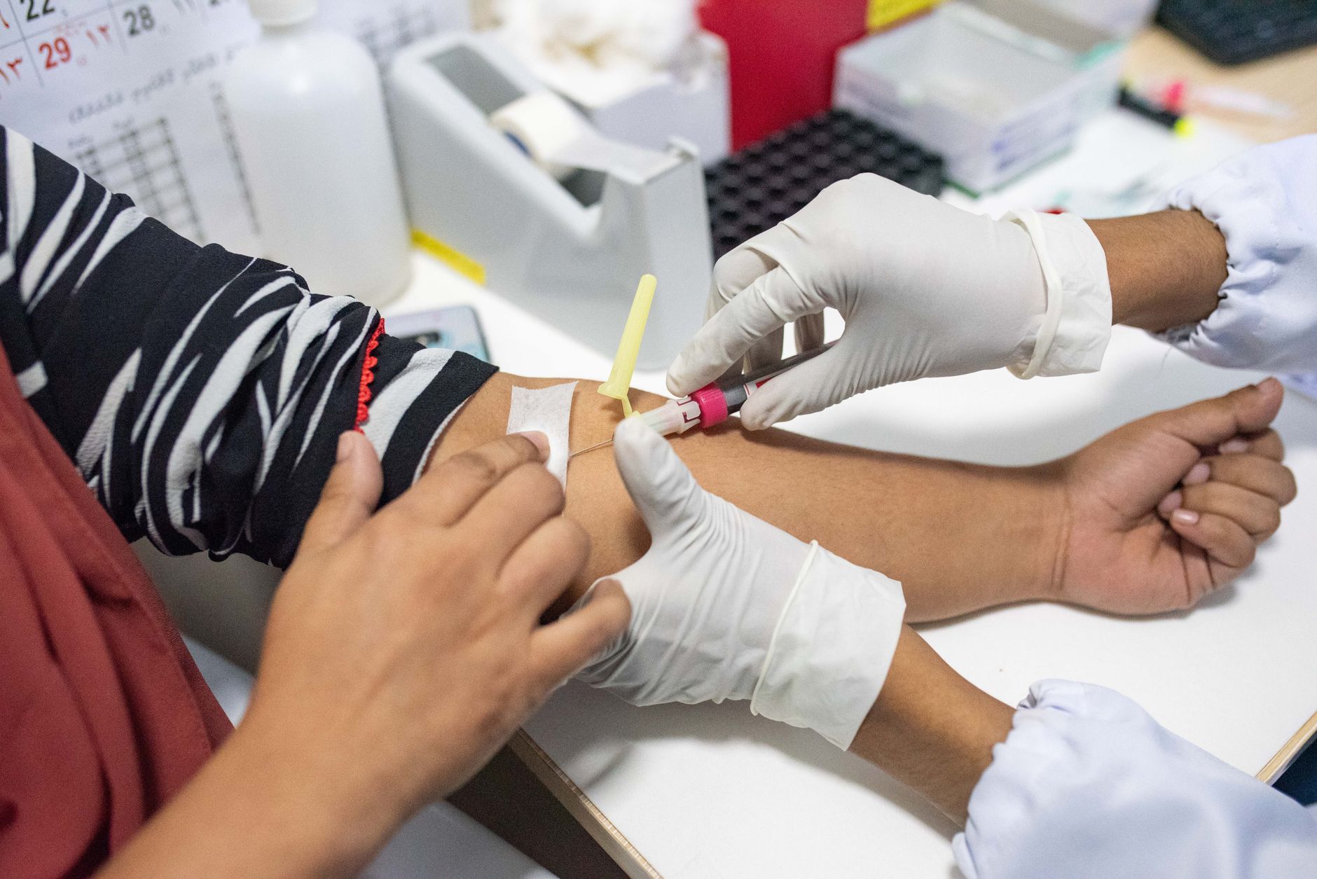 FAVN Rabies Antibody Test: What It Is, Who Needs One, and How It Works (2026 Guide)