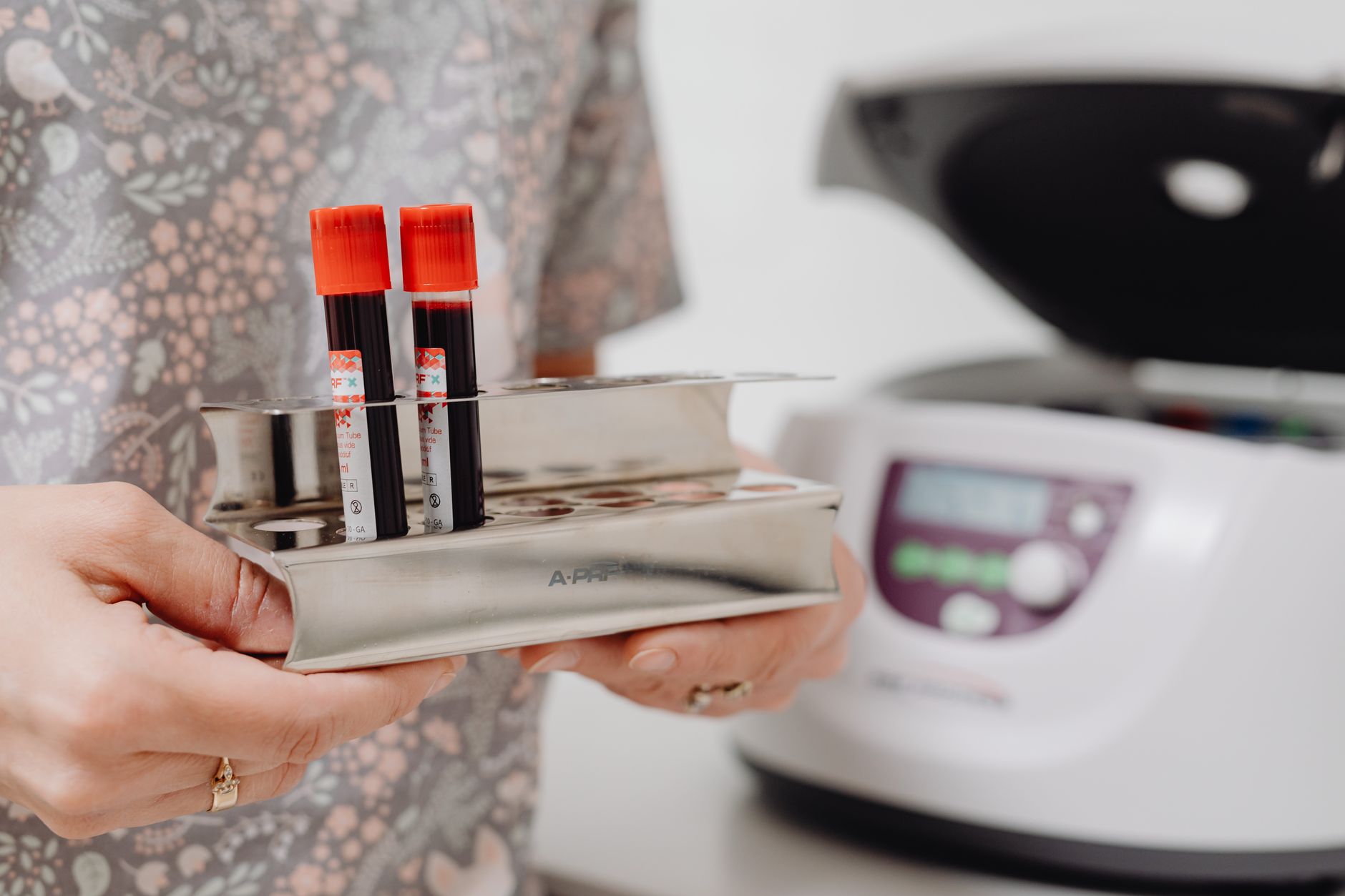 Dog Rabies Titer Test: Cost, Timing, and How to Read the Results