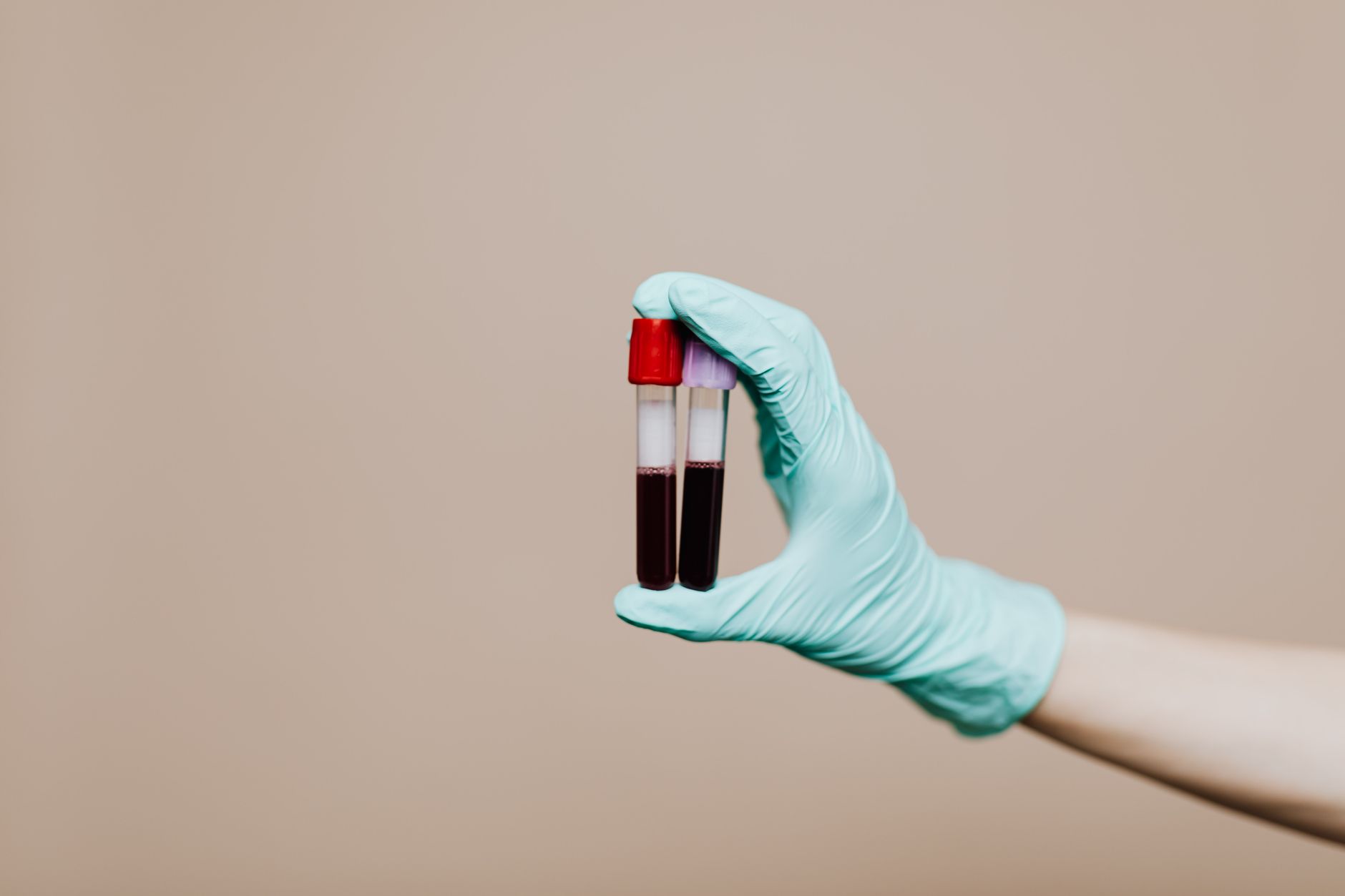 Rabies Titer Test: What It Is, Cost & When You Need One