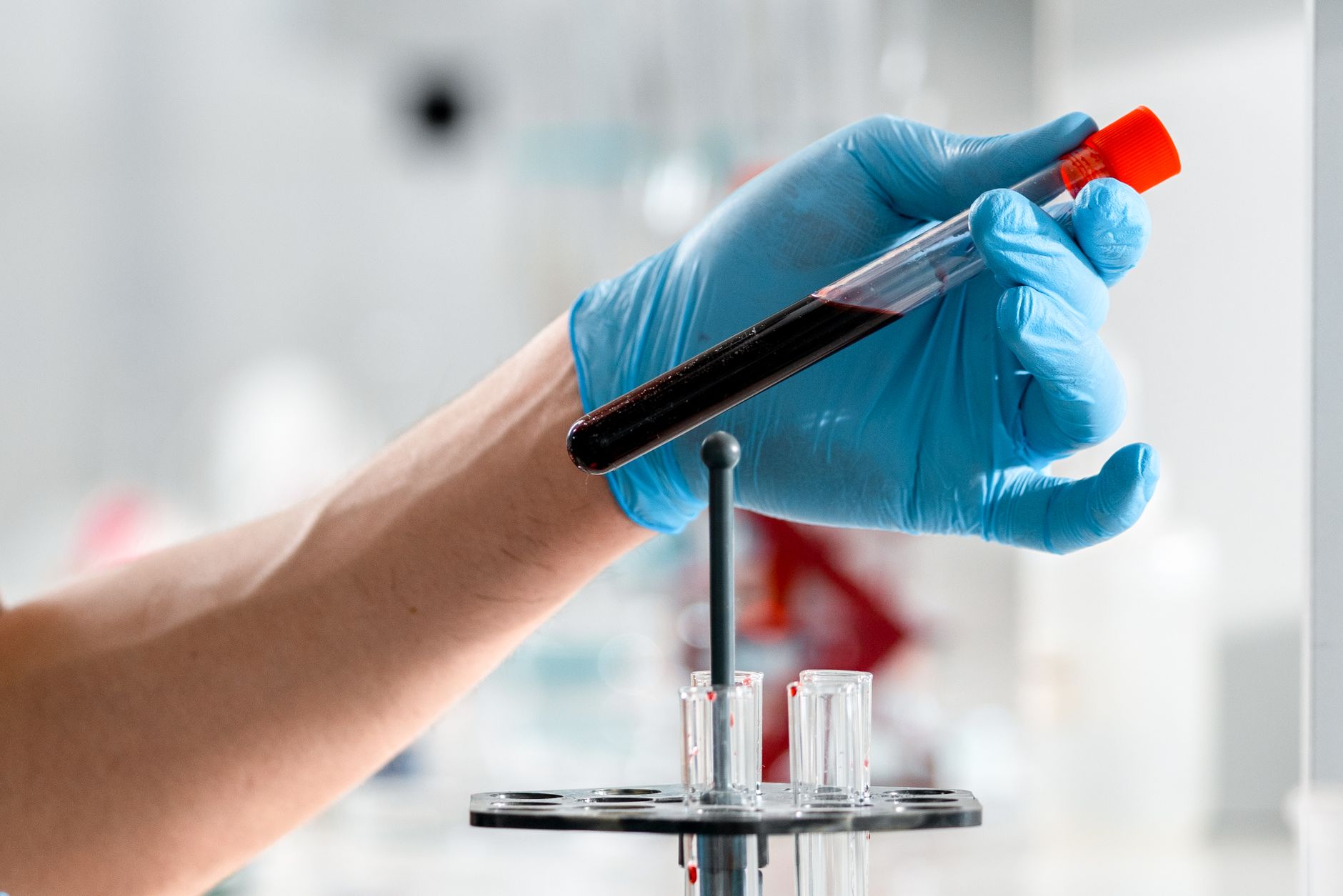 Rabies Titre Test: Requirements, Cost, and Timing Explained
