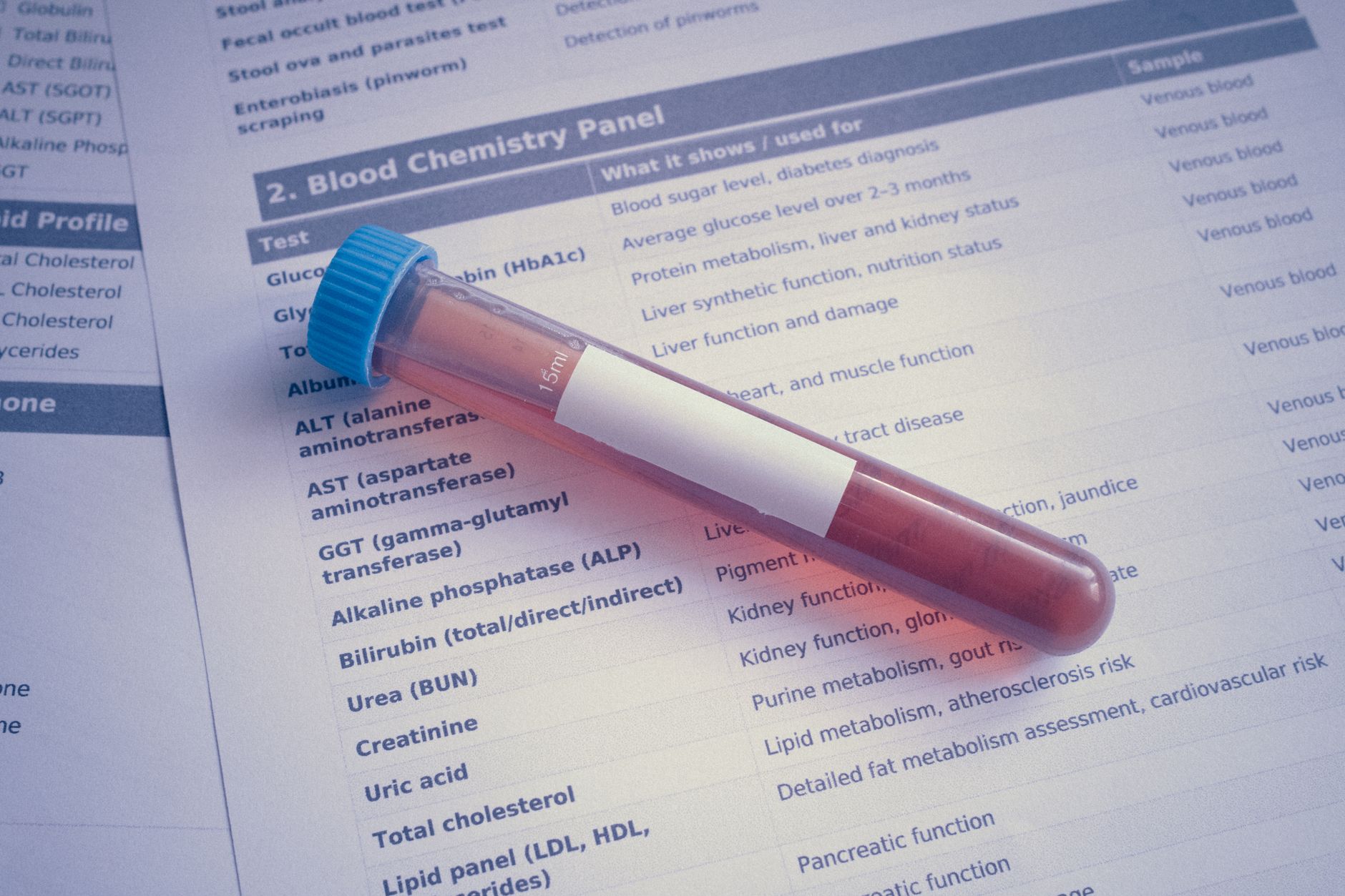 veterinarian drawing blood sample from dog for lab test