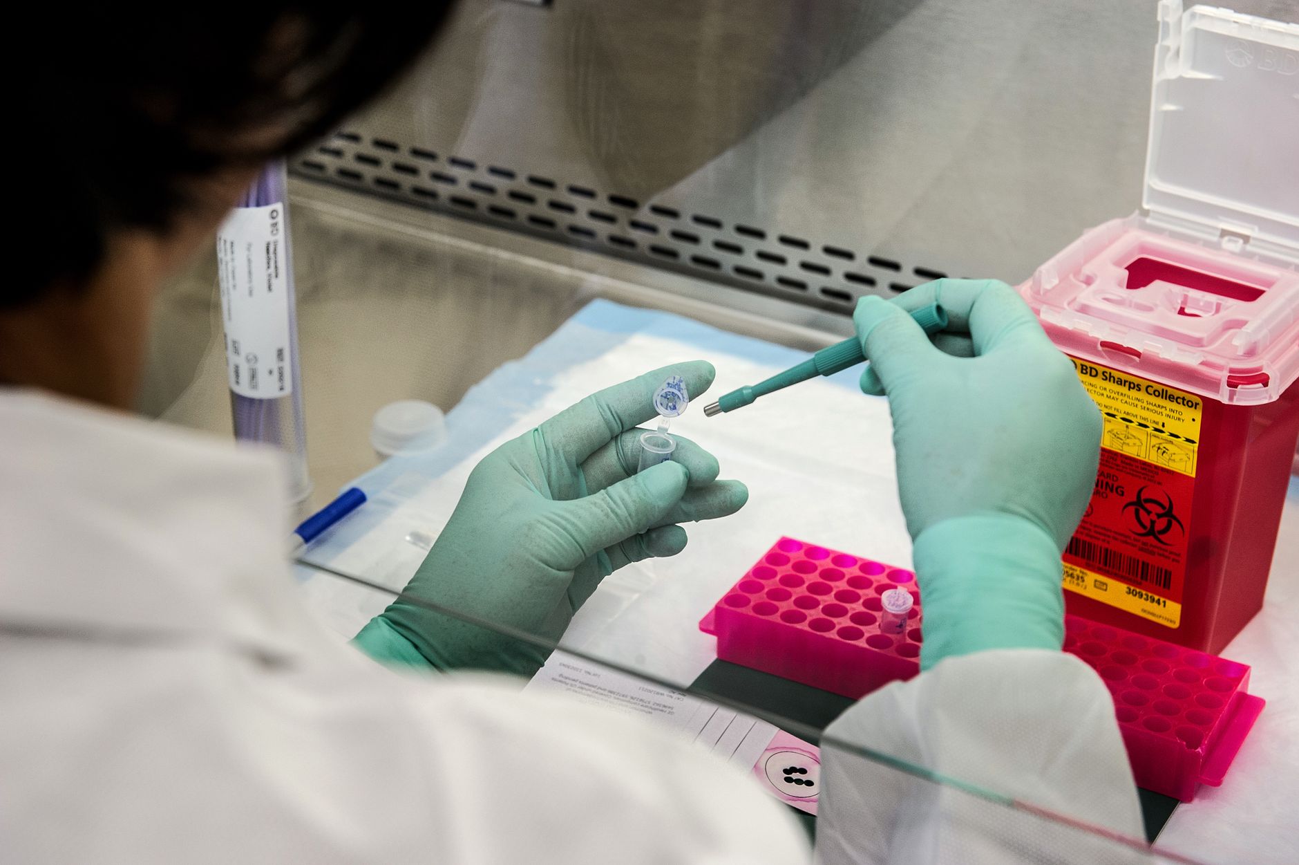 laboratory technician pipetting serum samples fluorescent test