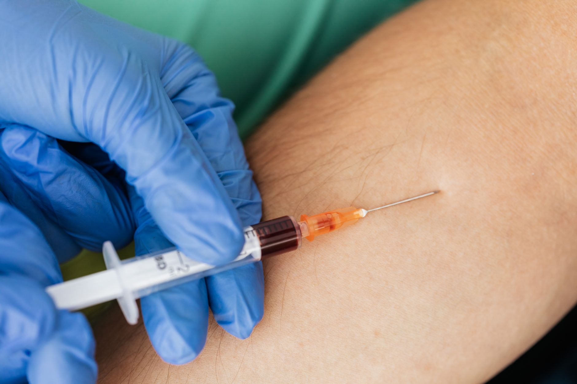 Rabies Blood Test: What It Measures, Who Needs One, and What It Can't Tell You