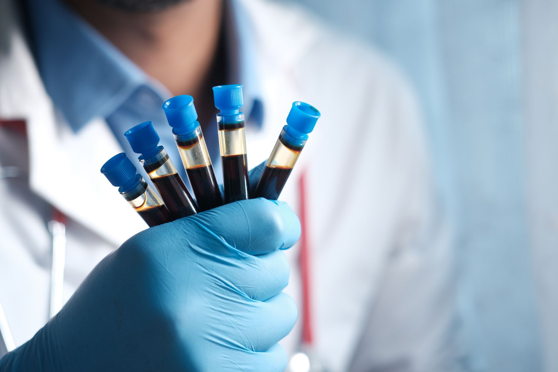 veterinarian collecting dog blood sample clinic for rabies titer