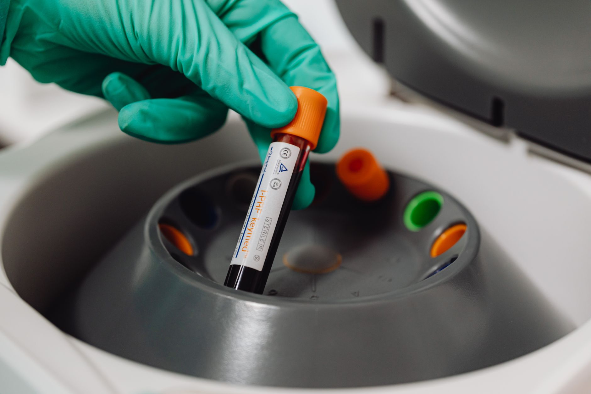 veterinarian drawing blood sample vial in animal clinic laboratory
