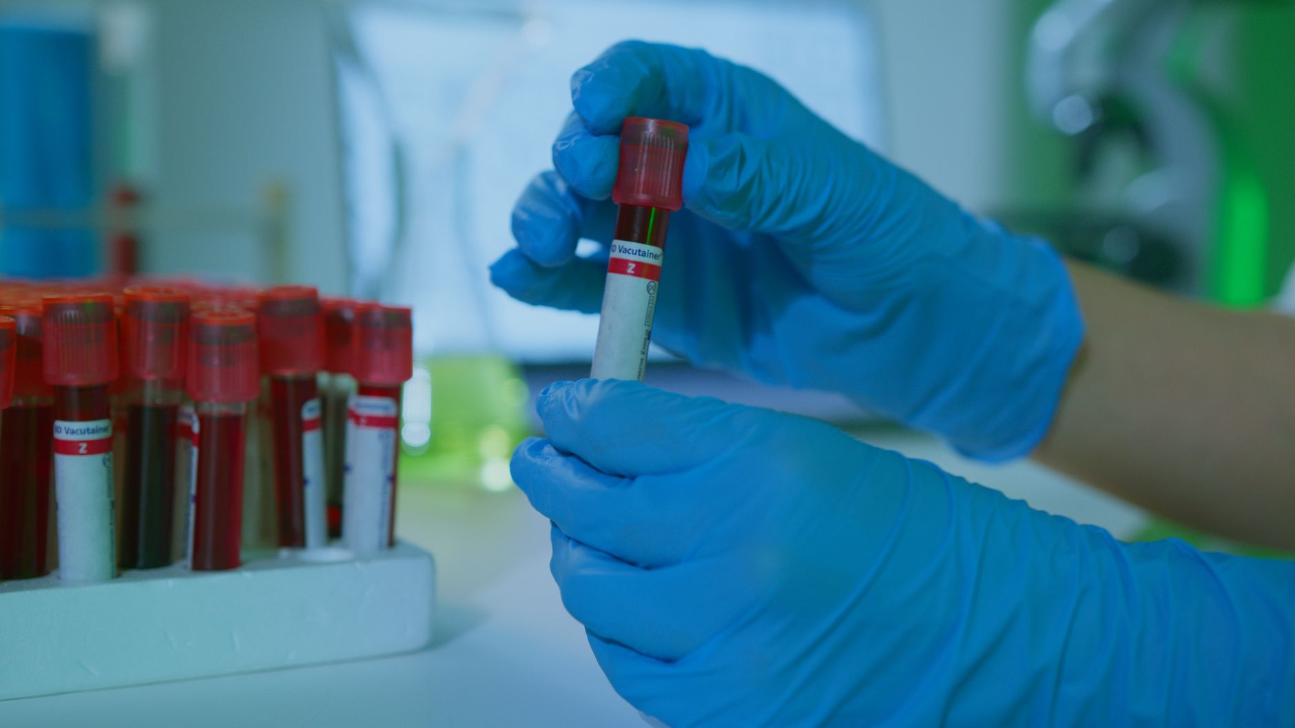 veterinary laboratory technician testing serum vials microscope