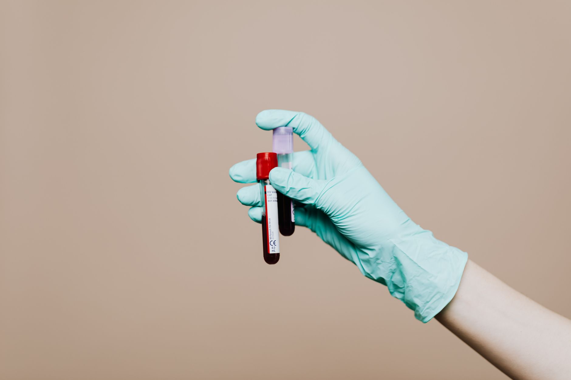 veterinarian collecting dog blood sample serum tube clinic exam table