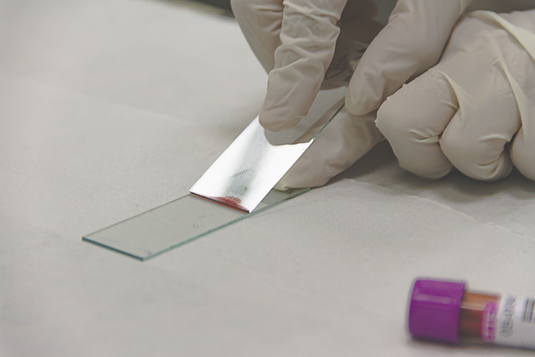 Rabies Antibody Test: What It Measures, Who Needs One, and How It Works